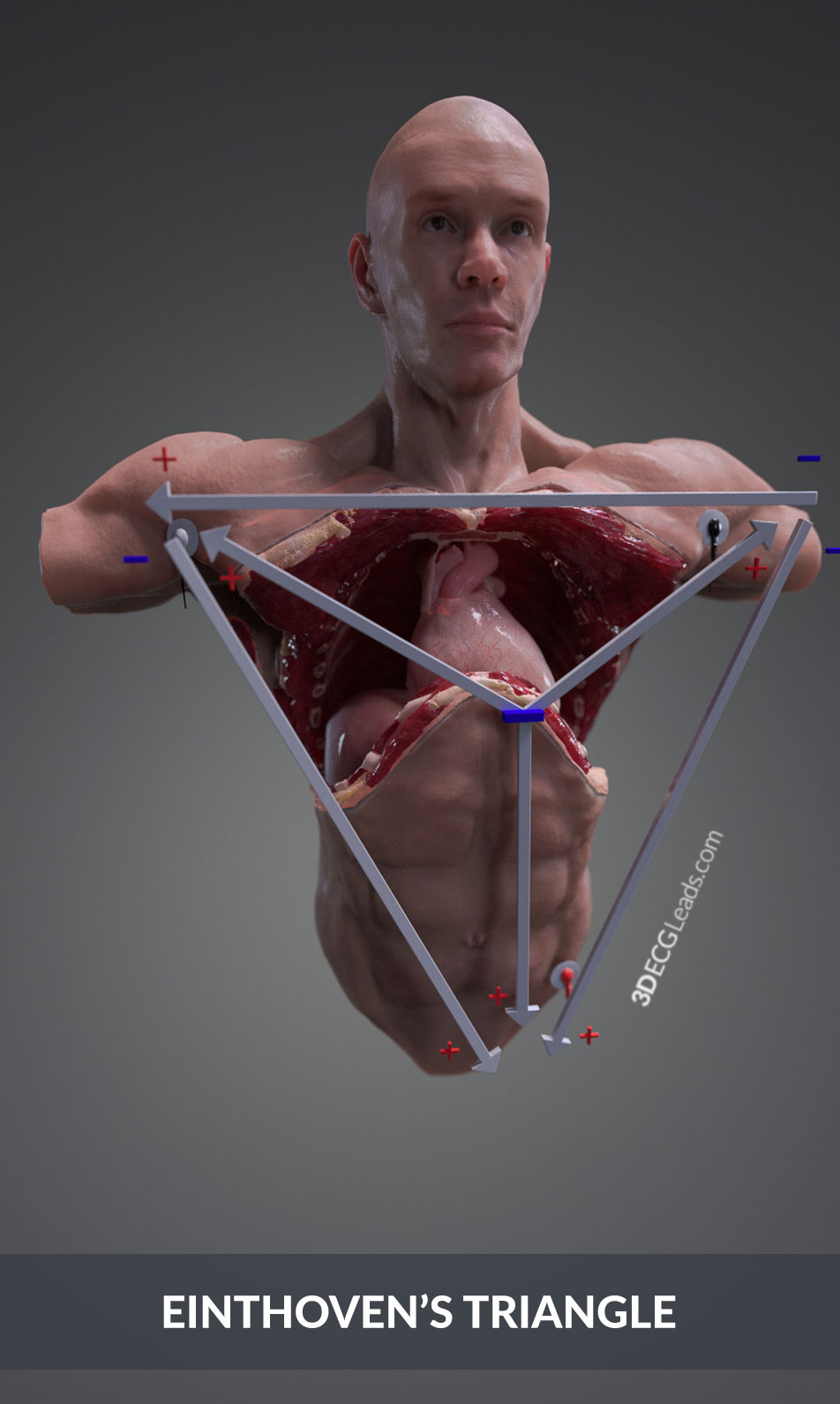 einthoven triangle